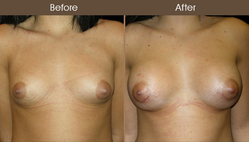 20202805155355_B82-Front